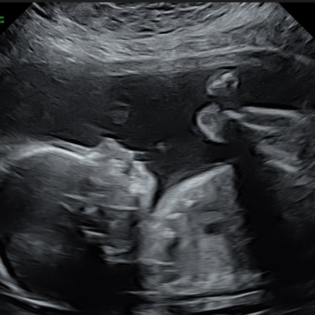 Photo shared by Grace for their Babylist baby registry.