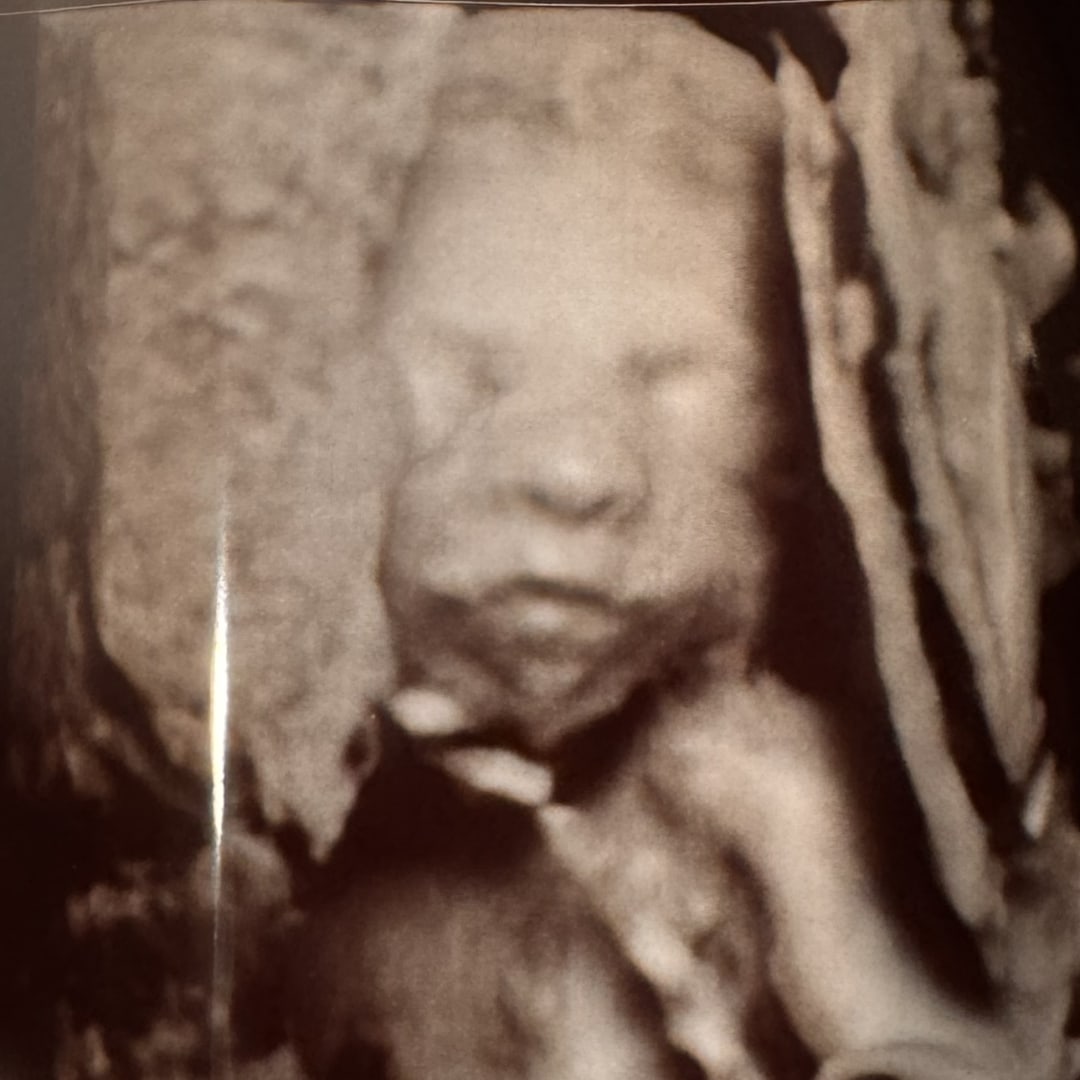 Photo shared by Devin for their Babylist baby registry.