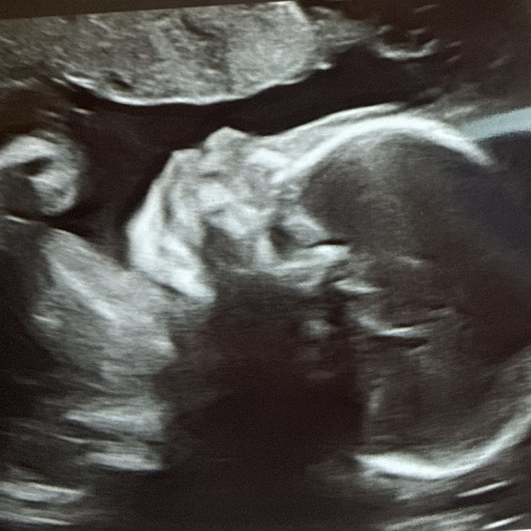 Photo shared by Krista for their Babylist baby registry.
