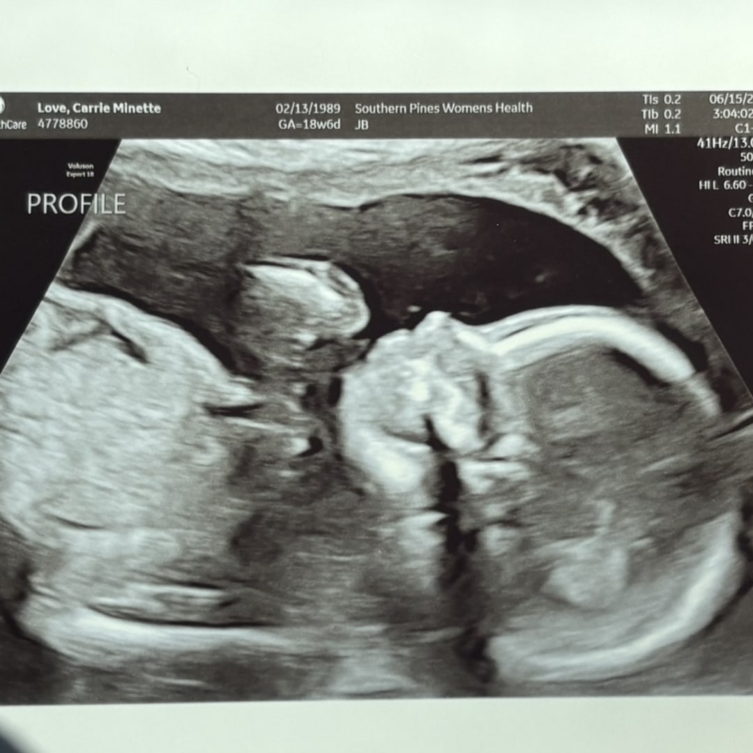 Photo shared by Carrie for their Babylist baby registry.
