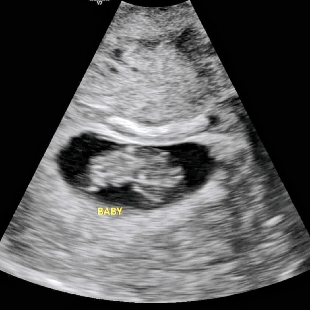 Photo shared by Savannah for their Babylist baby registry.