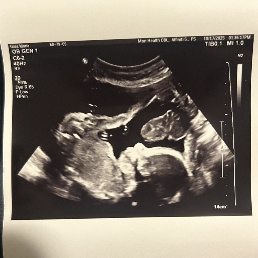 Photo shared by Maria for their Babylist baby registry.