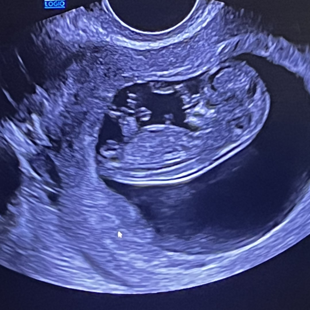 Photo shared by Aisha for their Babylist baby registry.