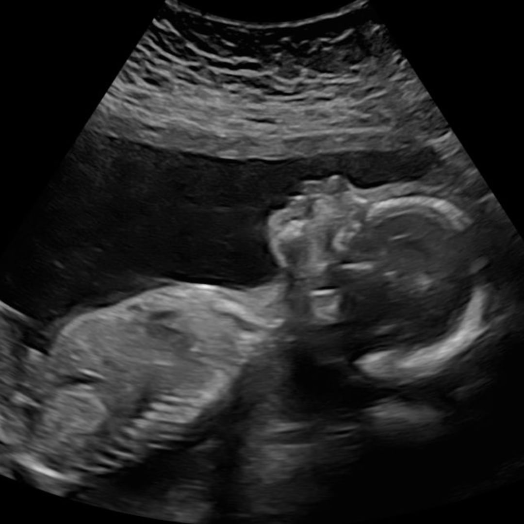 Photo shared by Eliana for their Babylist baby registry.