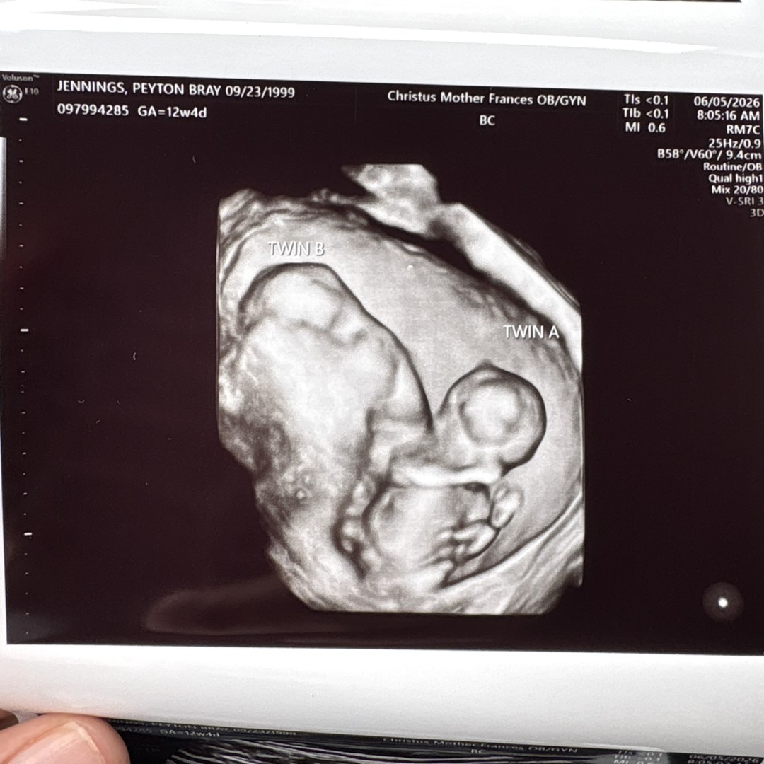 Photo shared by Peyton for their Babylist baby registry.