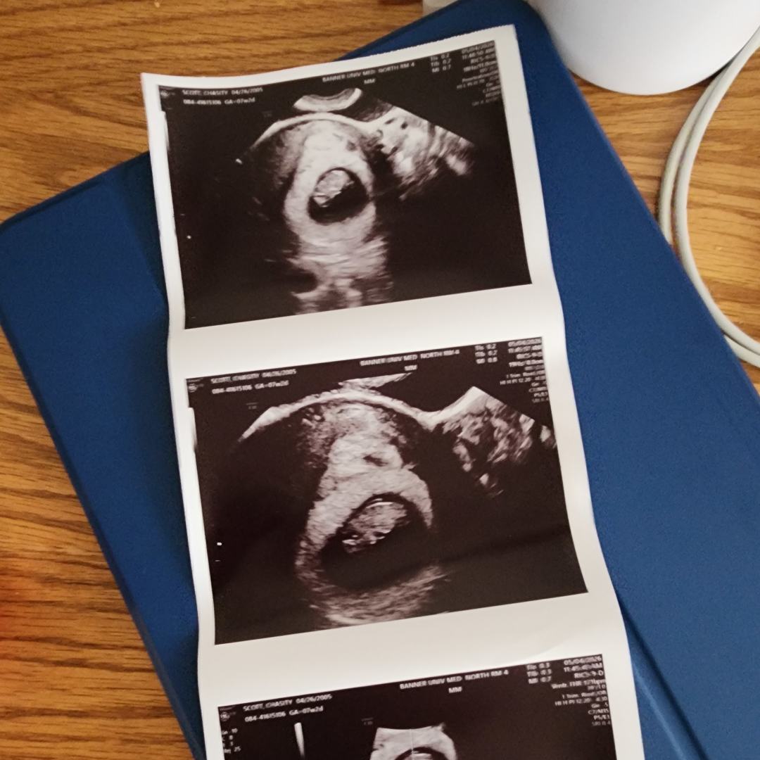 Photo shared by Chasity for their Babylist baby registry.