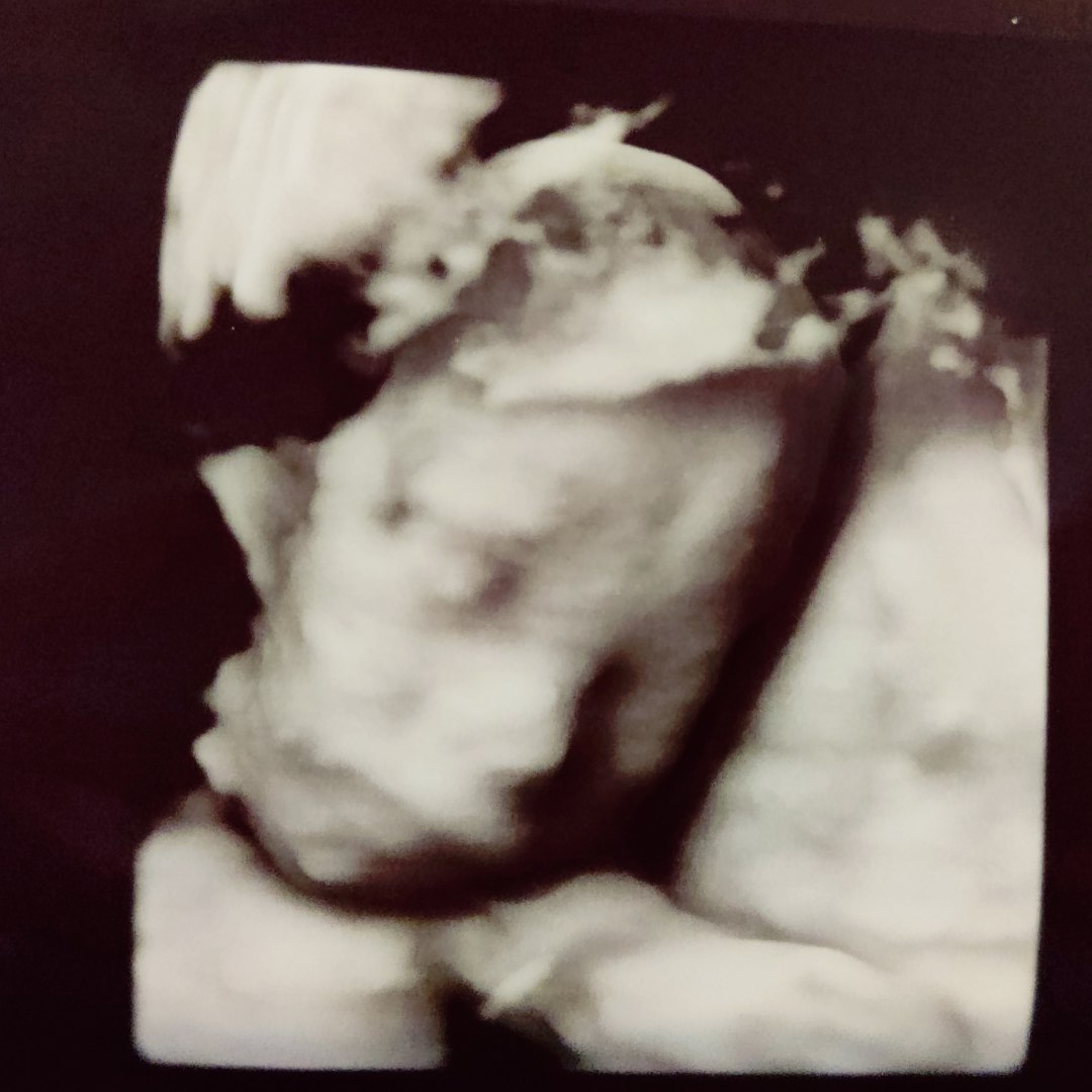Photo shared by Natalia for their Babylist baby registry.