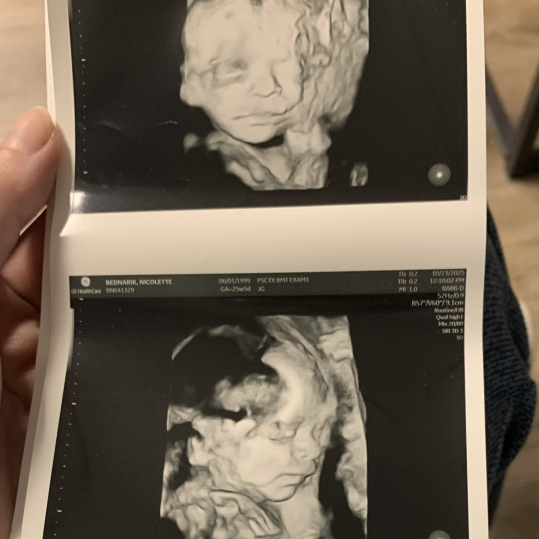 Photo shared by Nicolette for their Babylist baby registry.