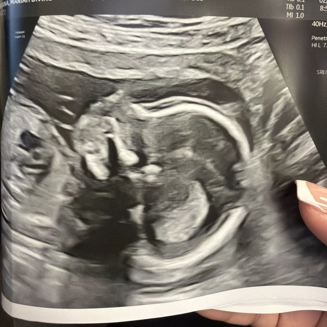 Photo shared by Mariah for their Babylist baby registry.