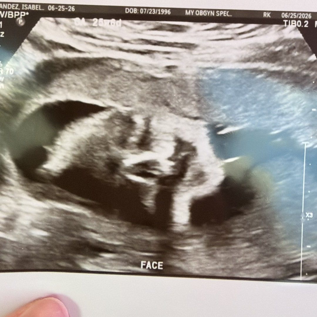 Photo shared by Isabelle for their Babylist baby registry.