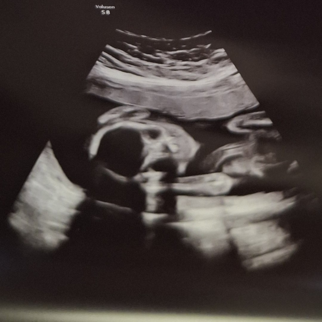 Photo shared by Ana for their Babylist baby registry.