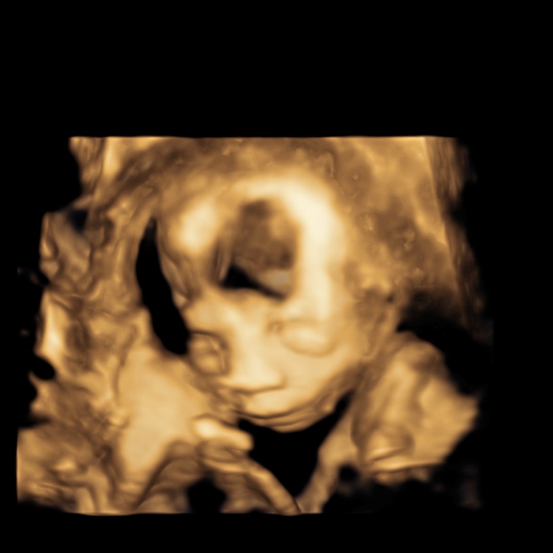 Photo shared by Lisette for their Babylist baby registry.