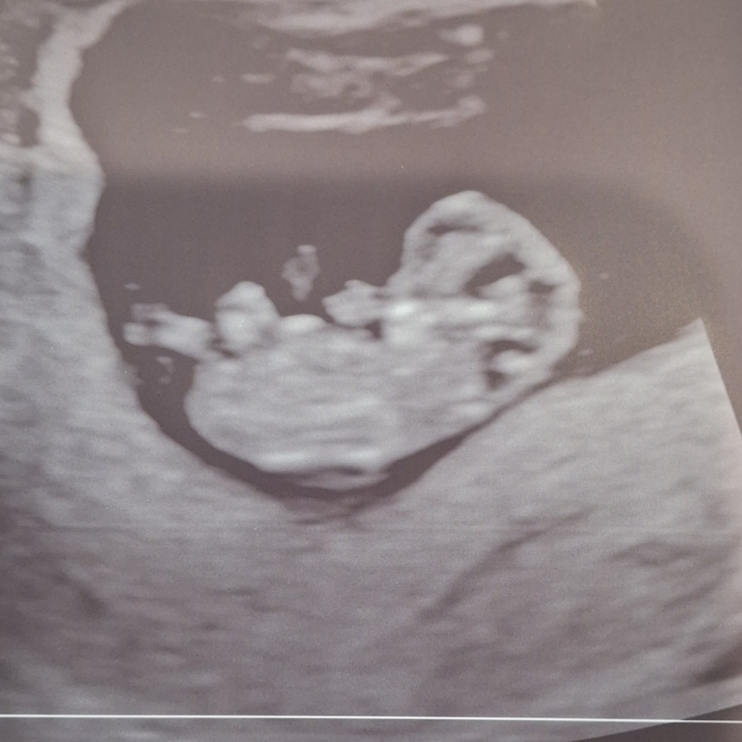 Photo shared by Abby for their Babylist baby registry.
