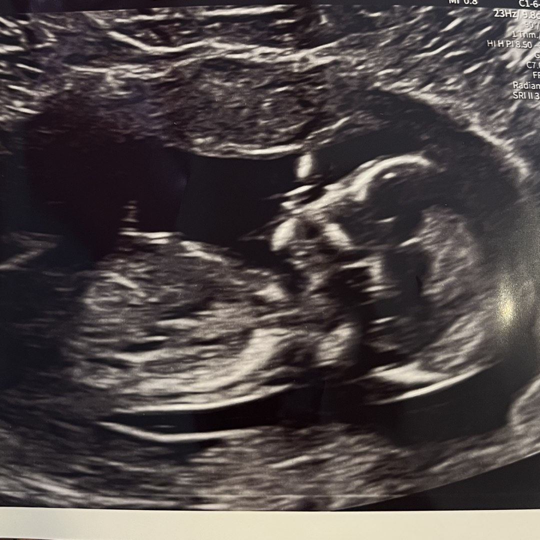 Photo shared by Sadie for their Babylist baby registry.