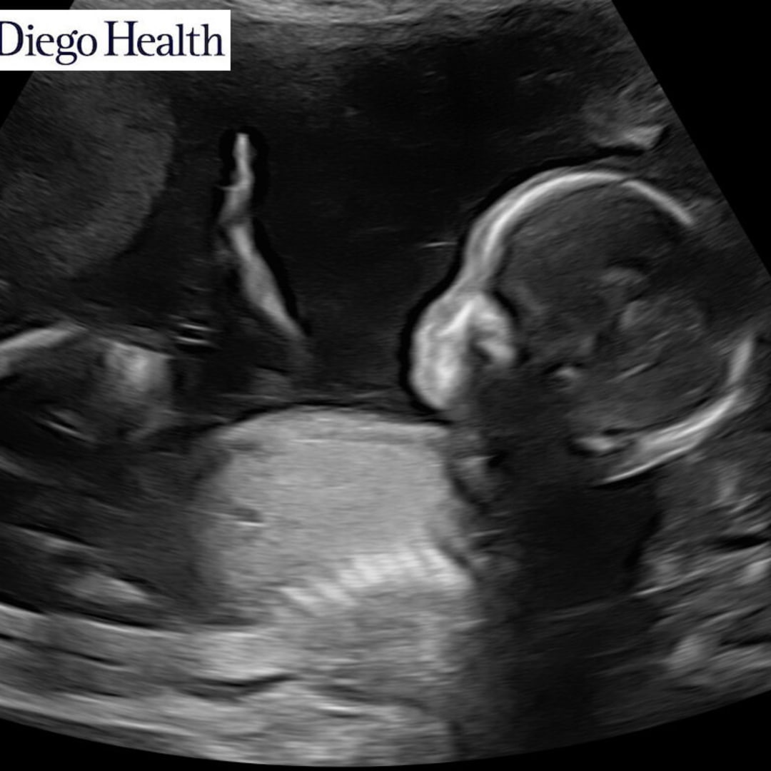 Photo shared by Fatima for their Babylist baby registry.