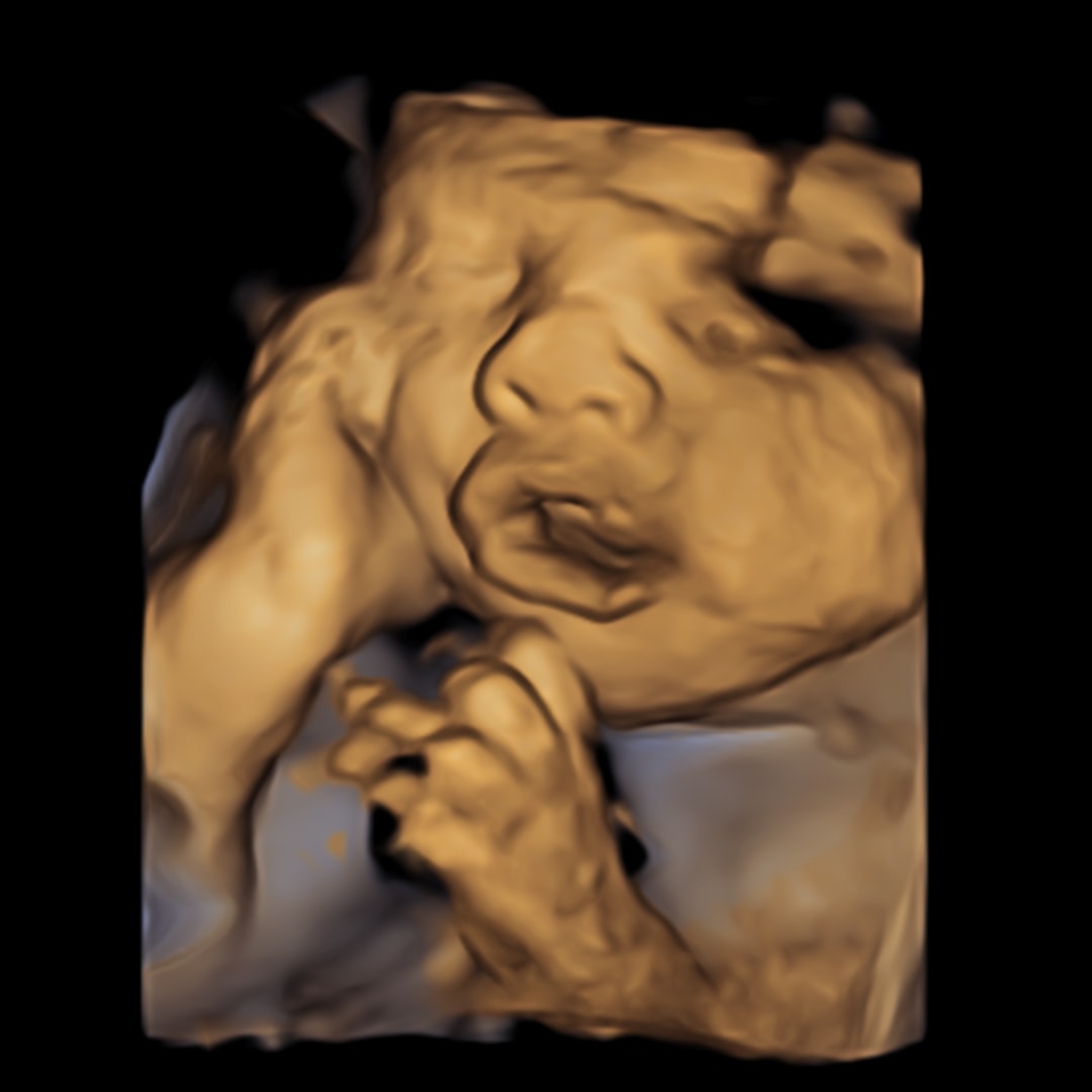 Photo shared by Delaney for their Babylist baby registry.