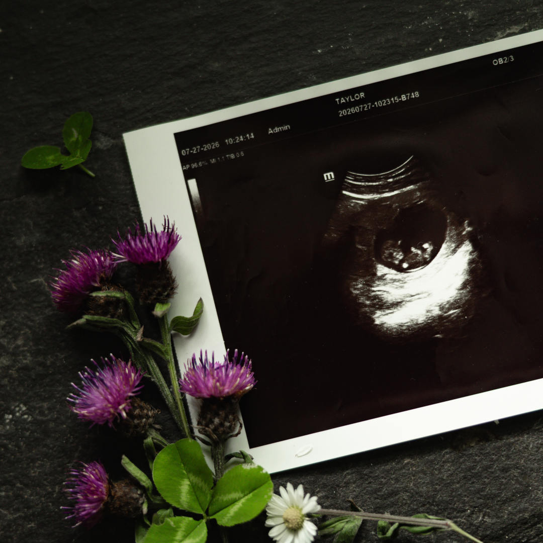 Photo shared by Shelby for their Babylist baby registry.