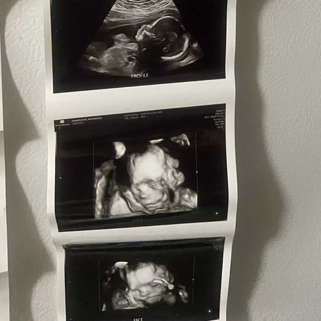 Photo shared by Amoreen for their Babylist baby registry.