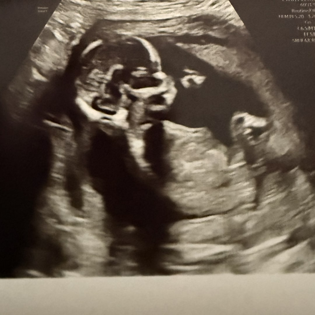 Photo shared by Brenda for their Babylist baby registry.