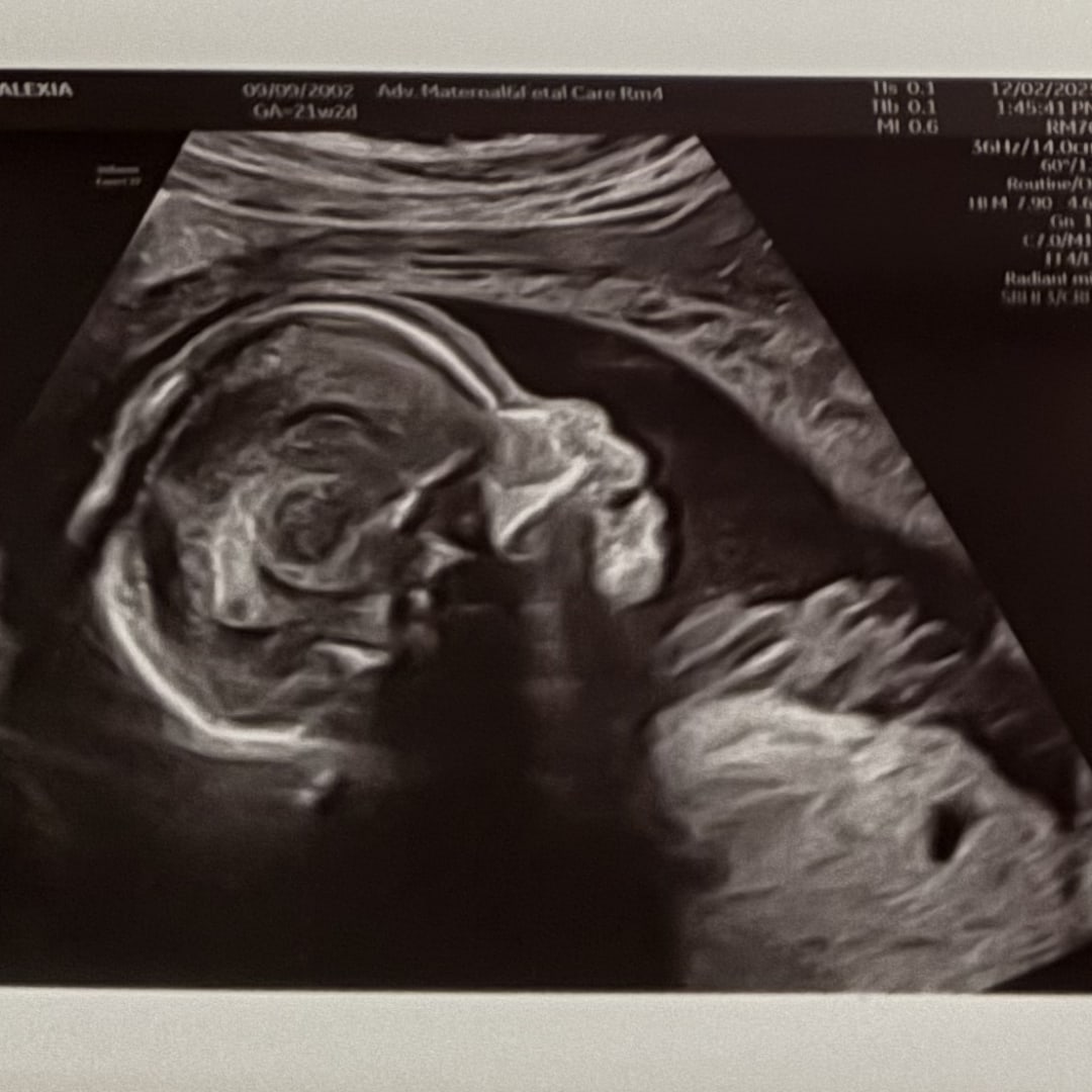 Photo shared by Alexia for their Babylist baby registry.