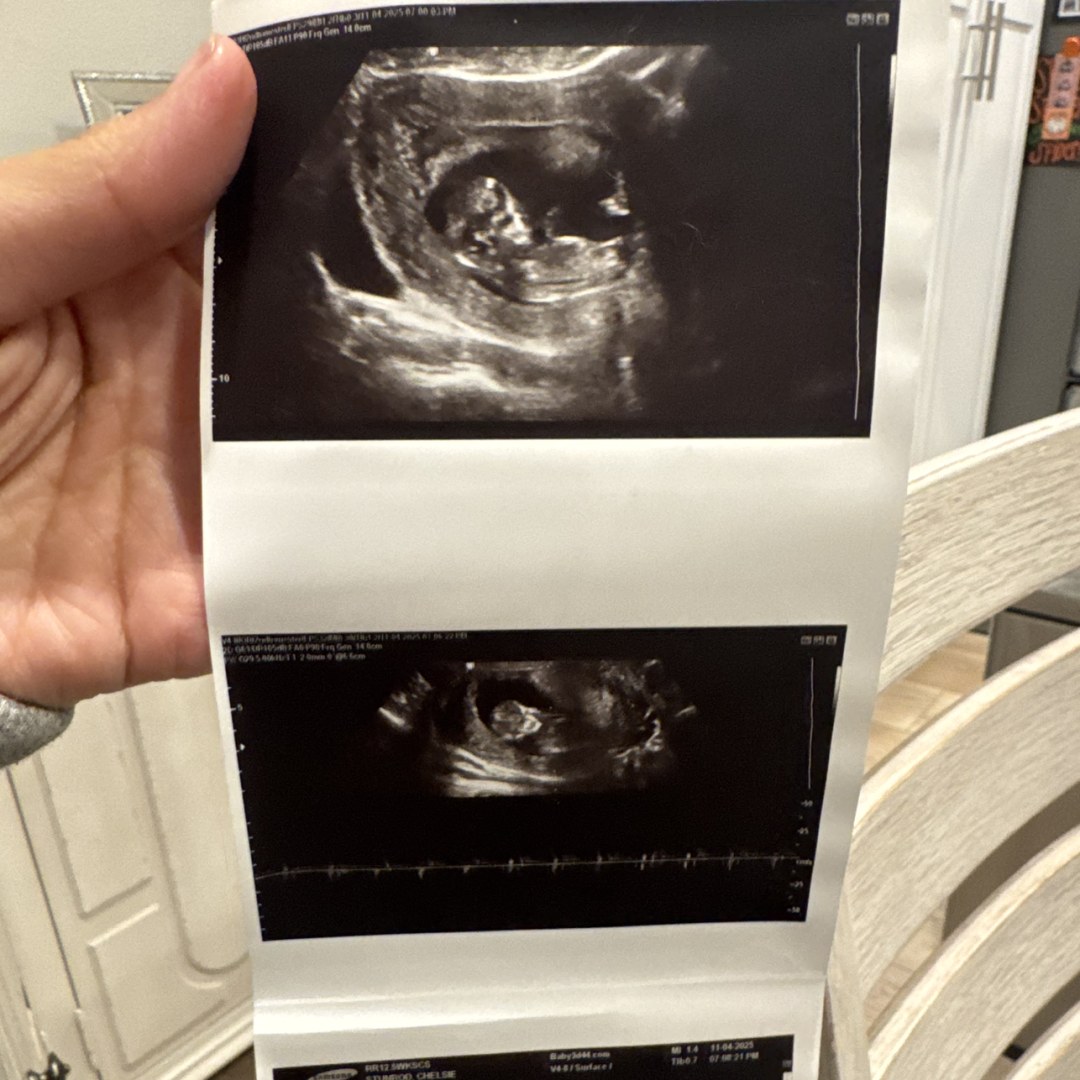 Photo shared by Chelsie for their Babylist baby registry.