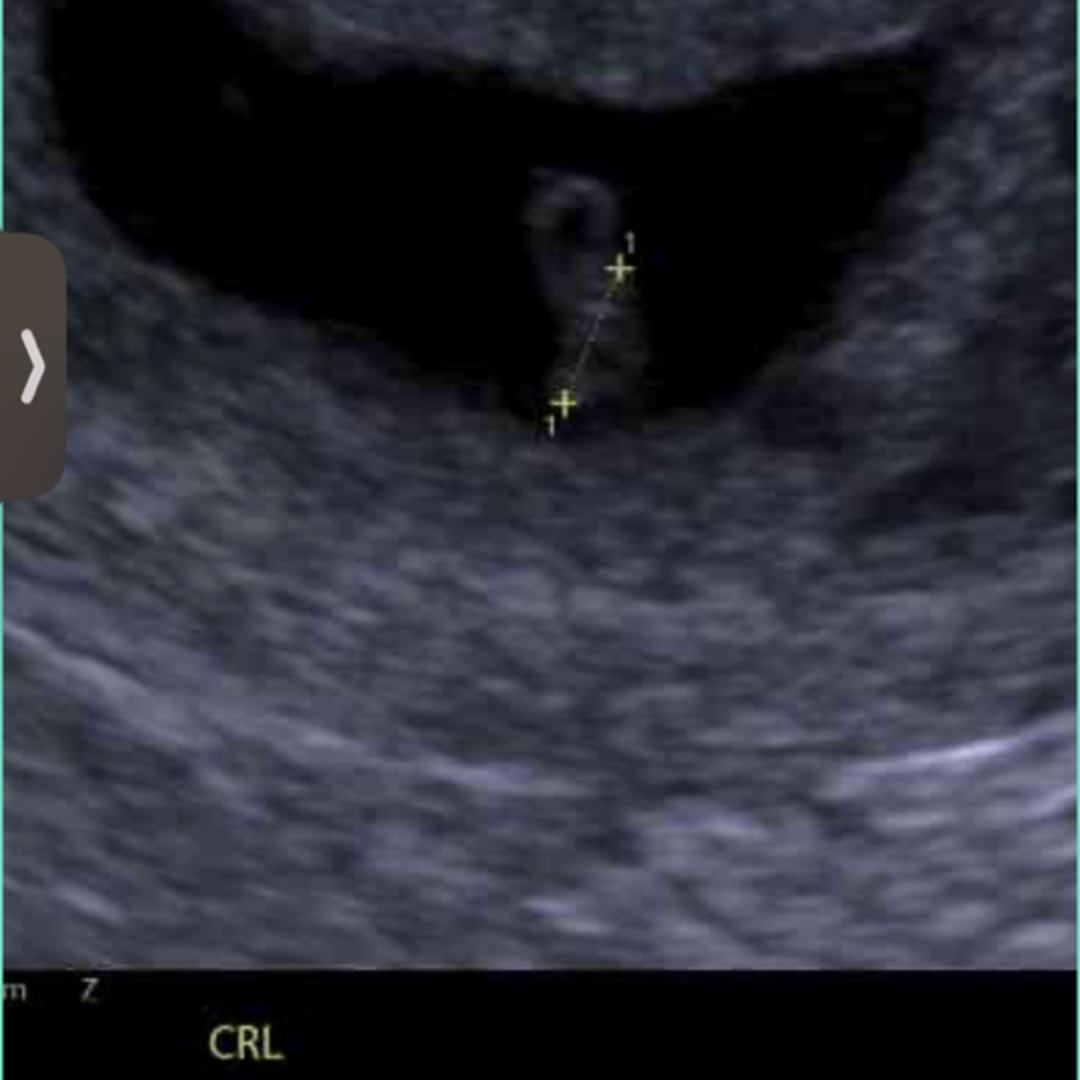 Photo shared by Britni for their Babylist baby registry.