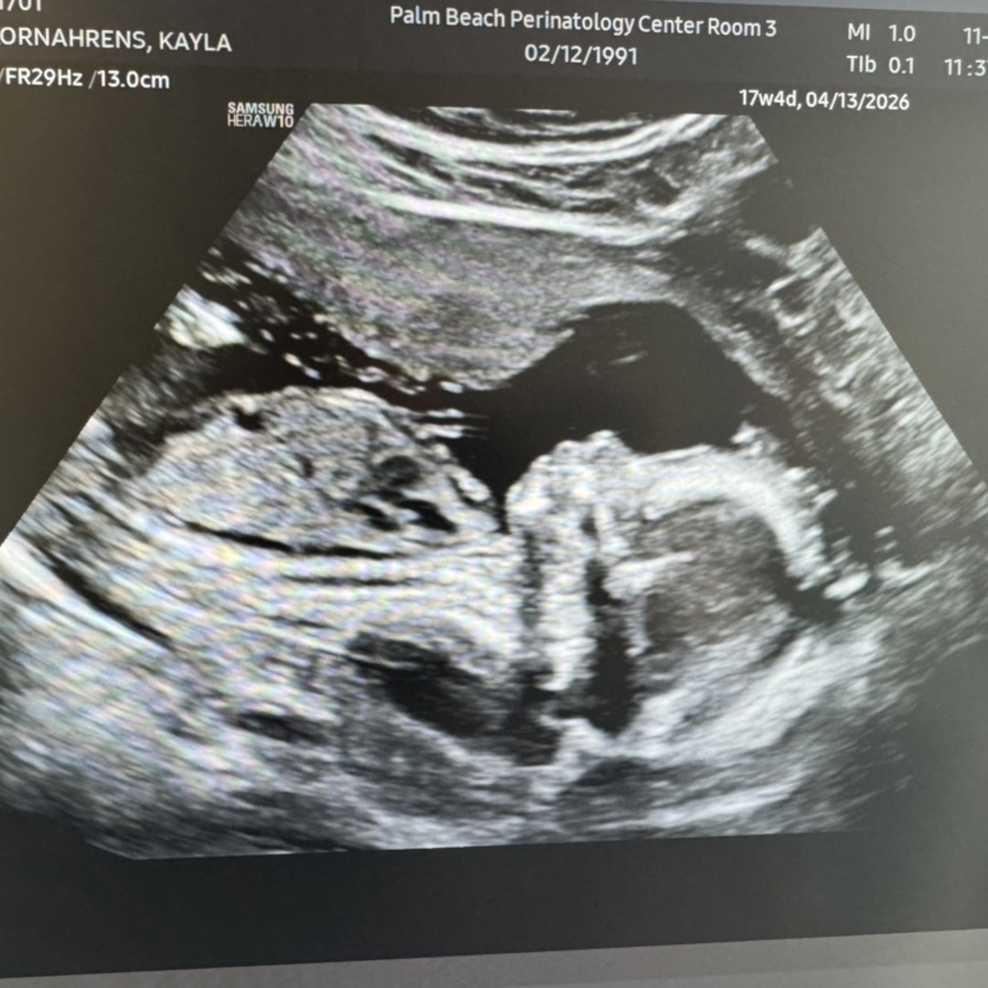 Photo shared by Kayla for their Babylist baby registry.