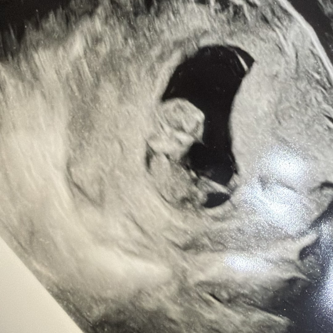 Photo shared by Marquisha for their Babylist baby registry.