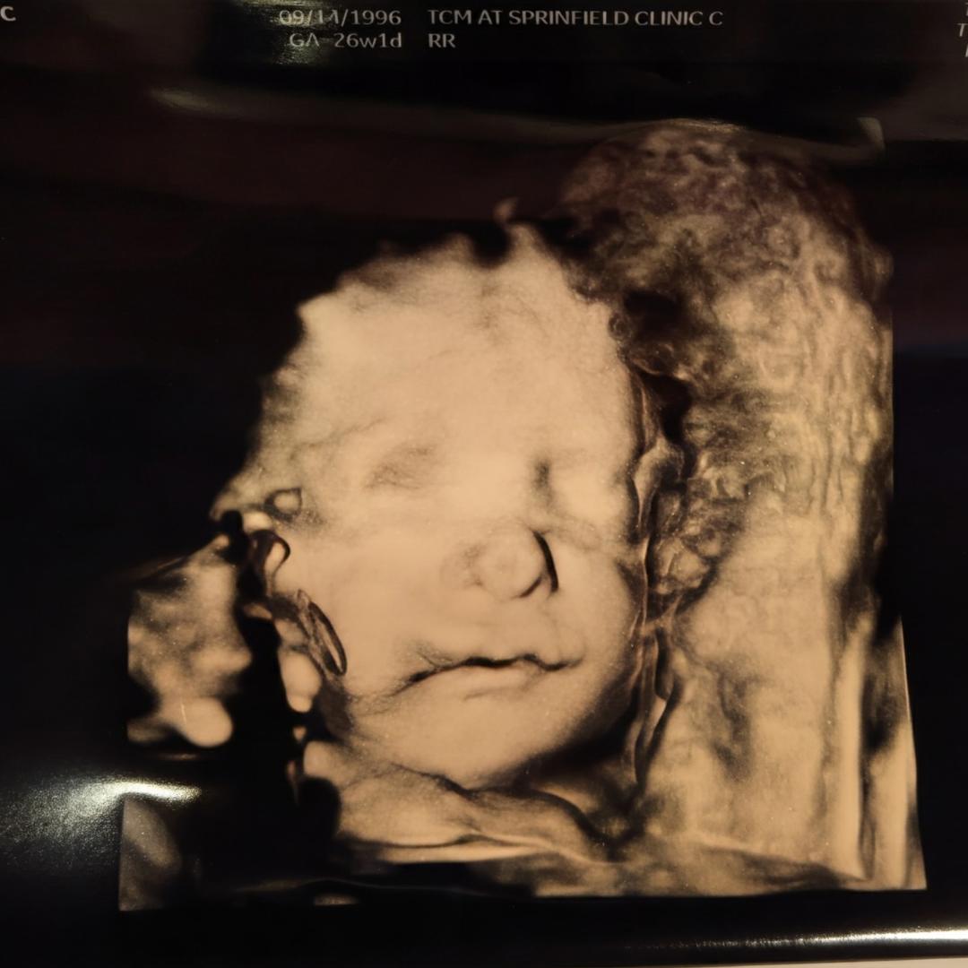 Photo shared by Marie for their Babylist baby registry.