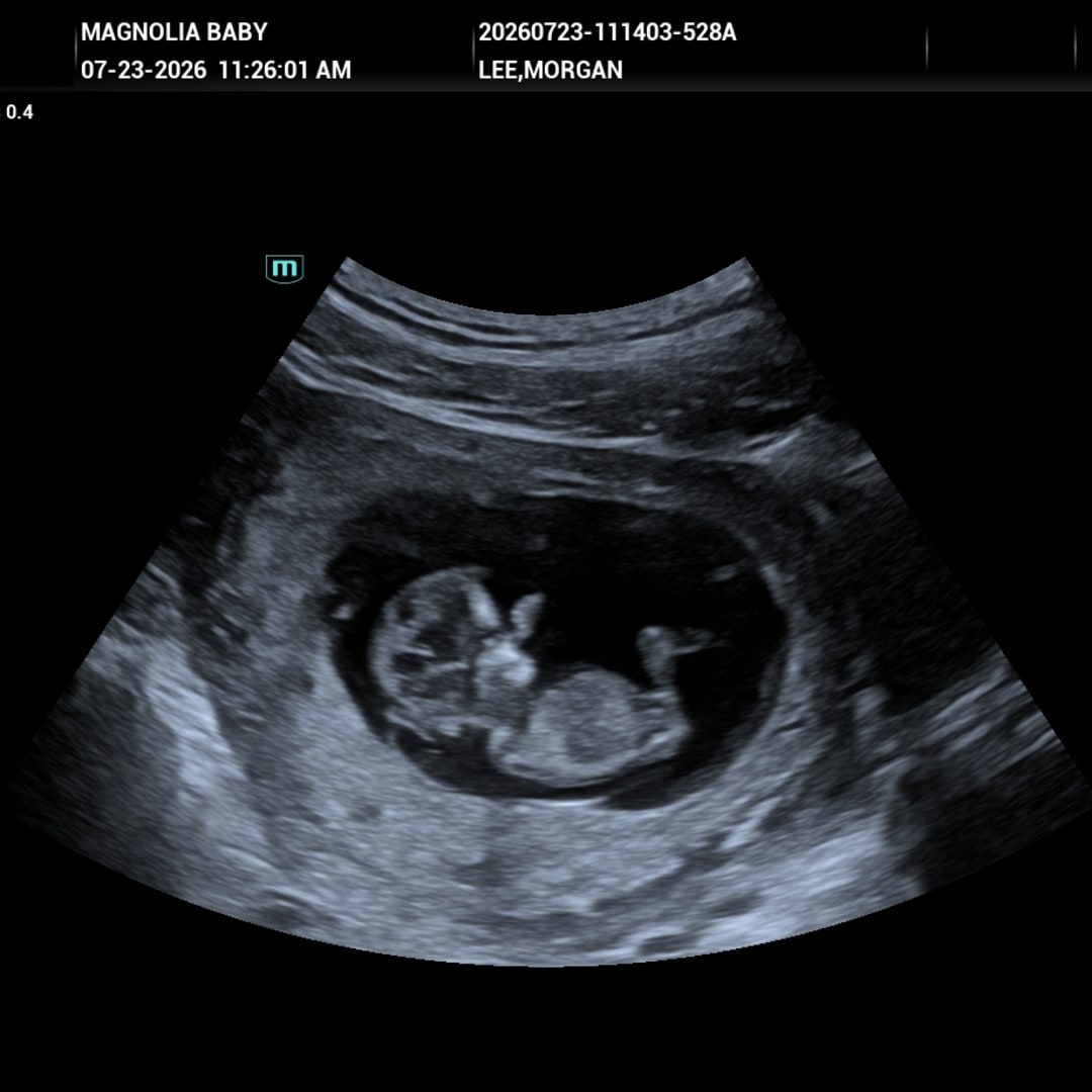 Photo shared by Morgan for their Babylist baby registry.