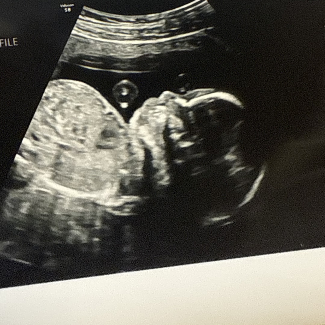 Photo shared by Destiny for their Babylist baby registry.