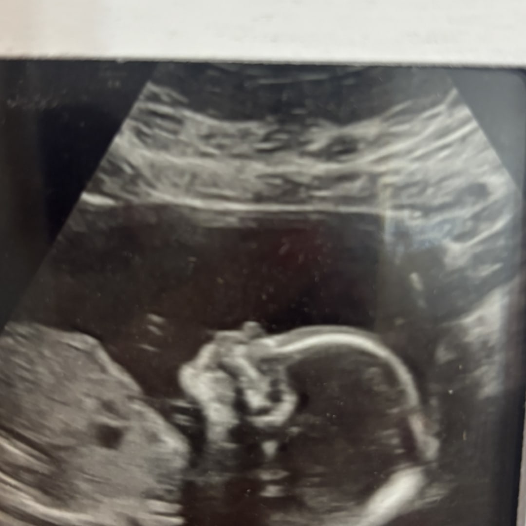 Photo shared by Allie for their Babylist baby registry.