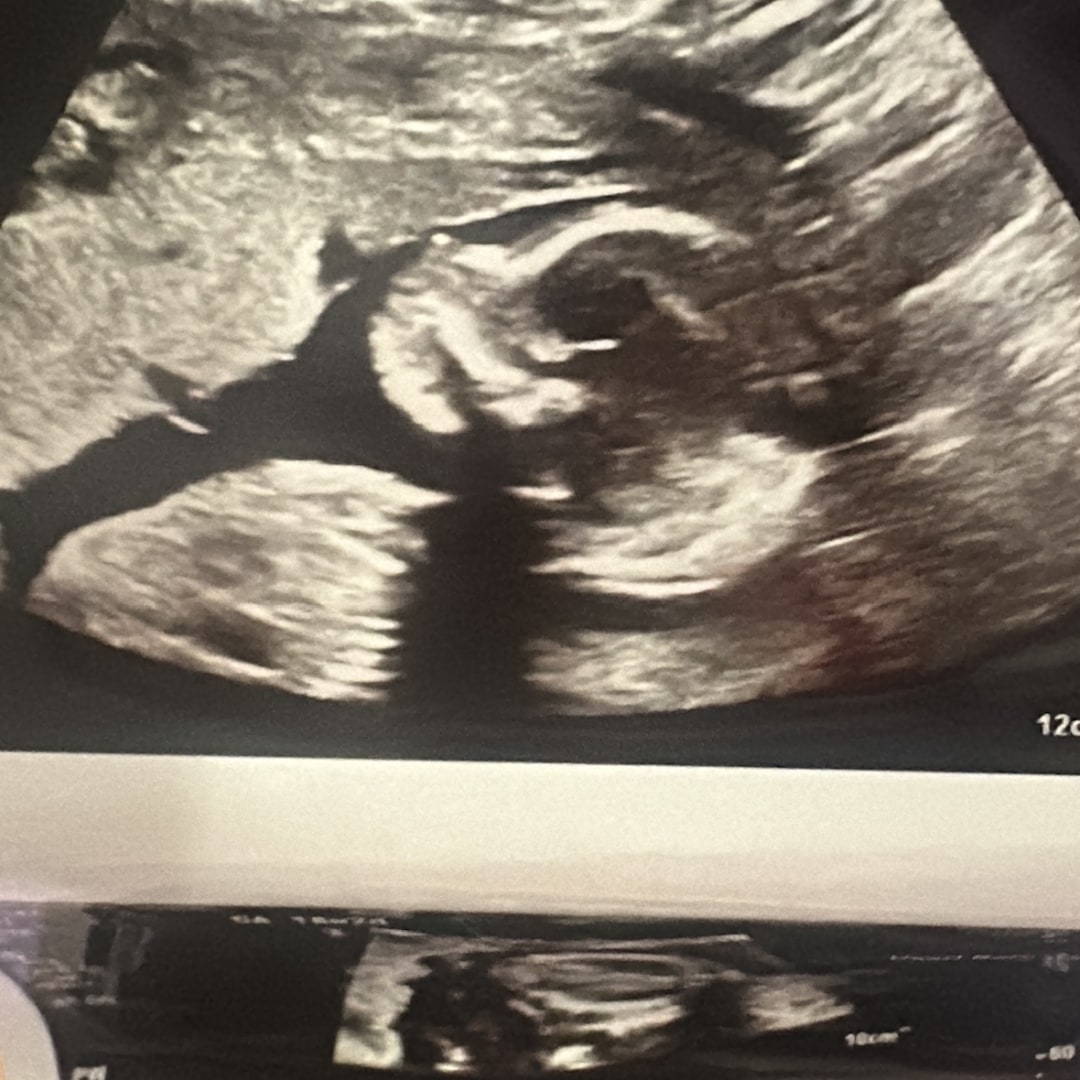 Photo shared by Yusleidy for their Babylist baby registry.