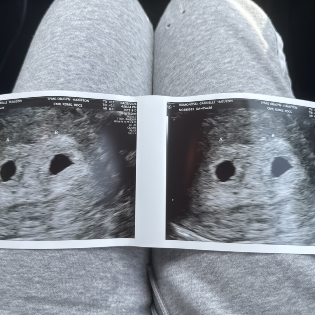 Photo shared by Gabrielle for their Babylist baby registry.