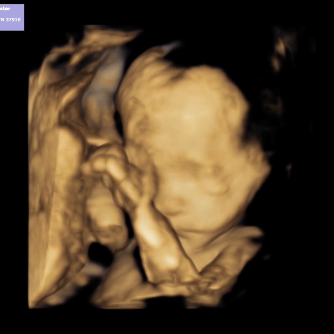 Photo shared by Annalee for their Babylist baby registry.