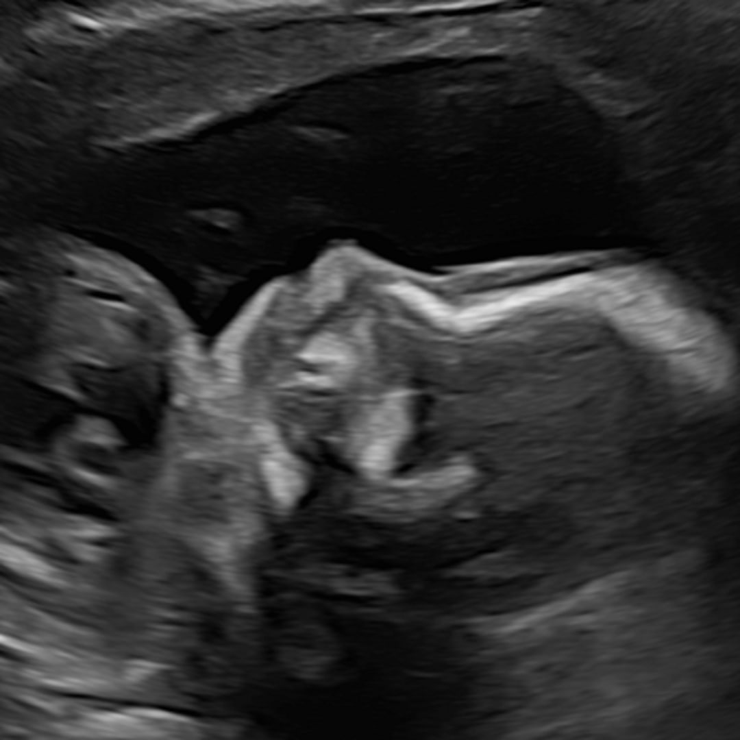 Photo shared by Meg for their Babylist baby registry.