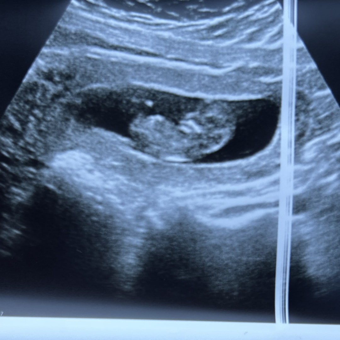 Photo shared by Vy for their Babylist baby registry.