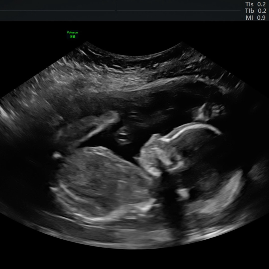Photo shared by Breana for their Babylist baby registry.