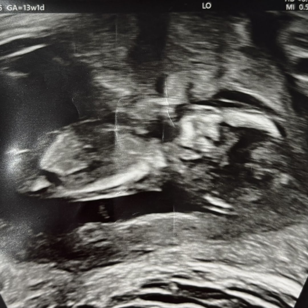 Photo shared by Kate for their Babylist baby registry.