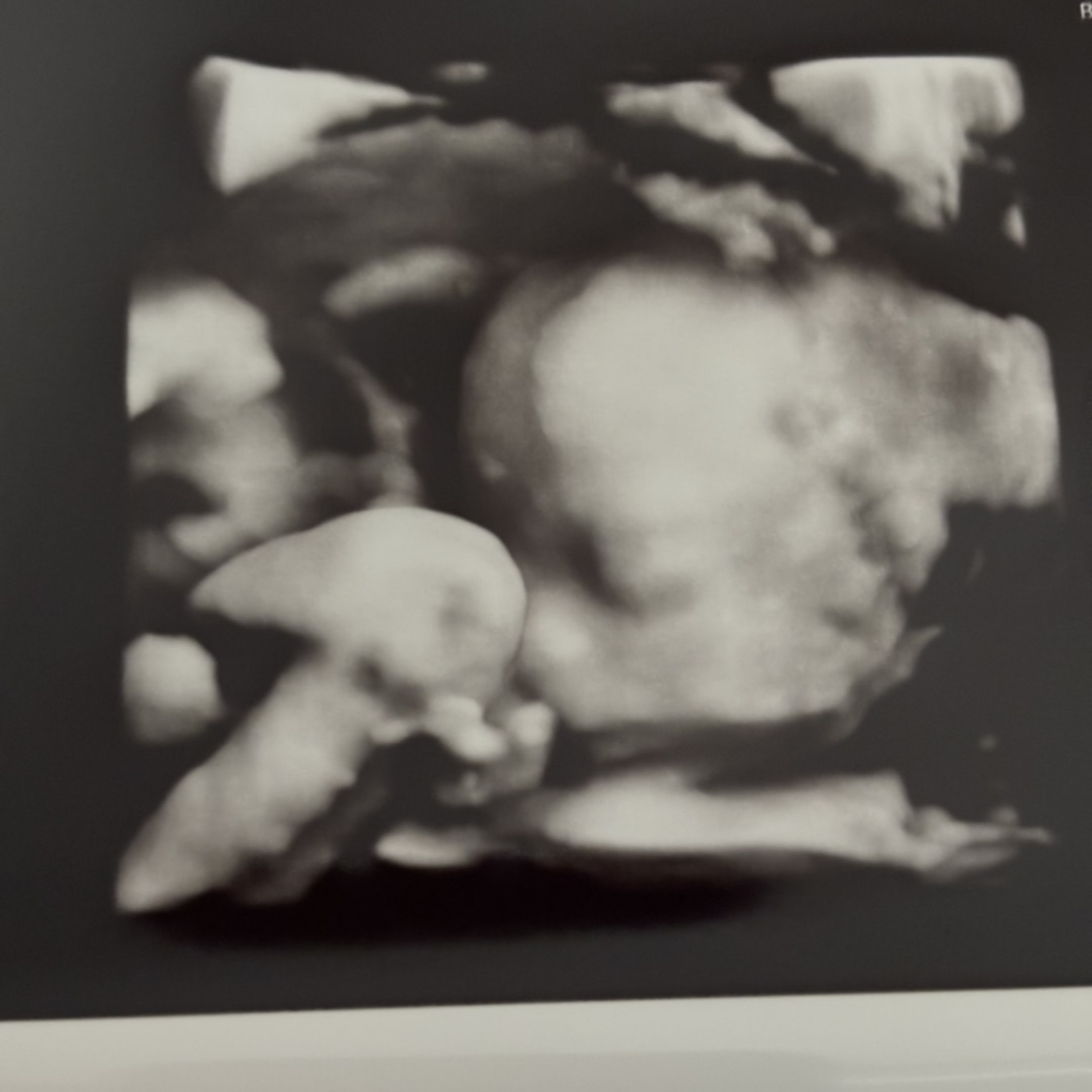 Photo shared by Erin for their Babylist baby registry.