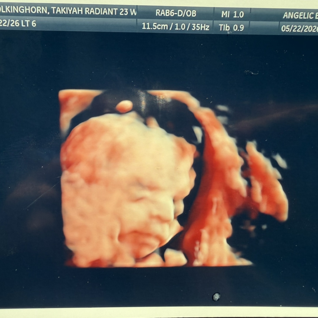 Photo shared by Takiyah for their Babylist baby registry.