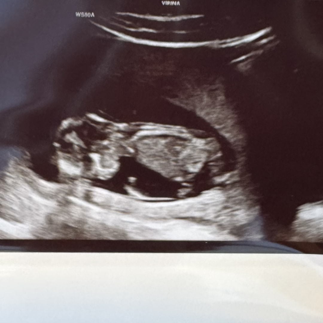 Photo shared by Christina for their Babylist baby registry.