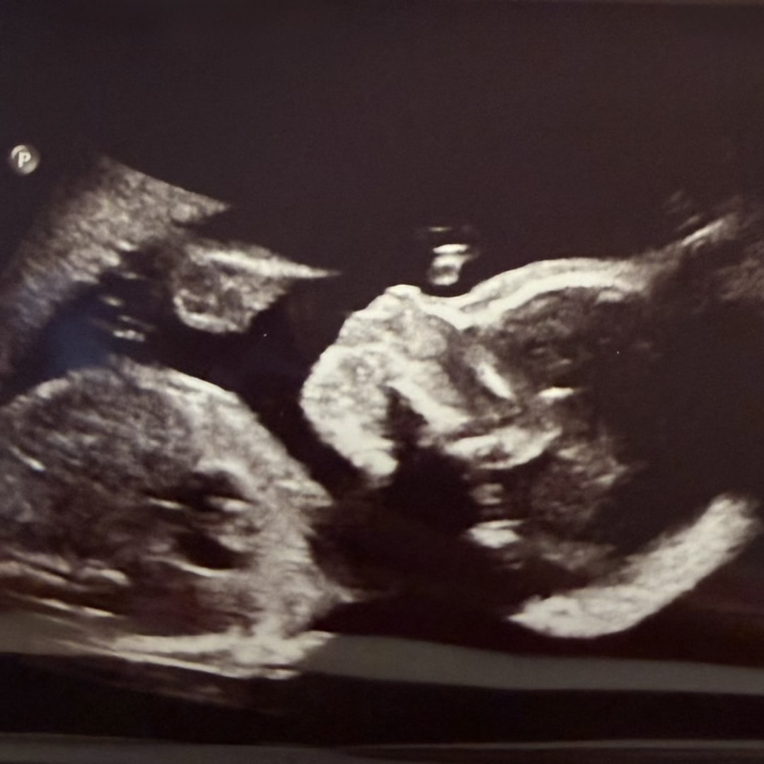 Photo shared by Elaina for their Babylist baby registry.