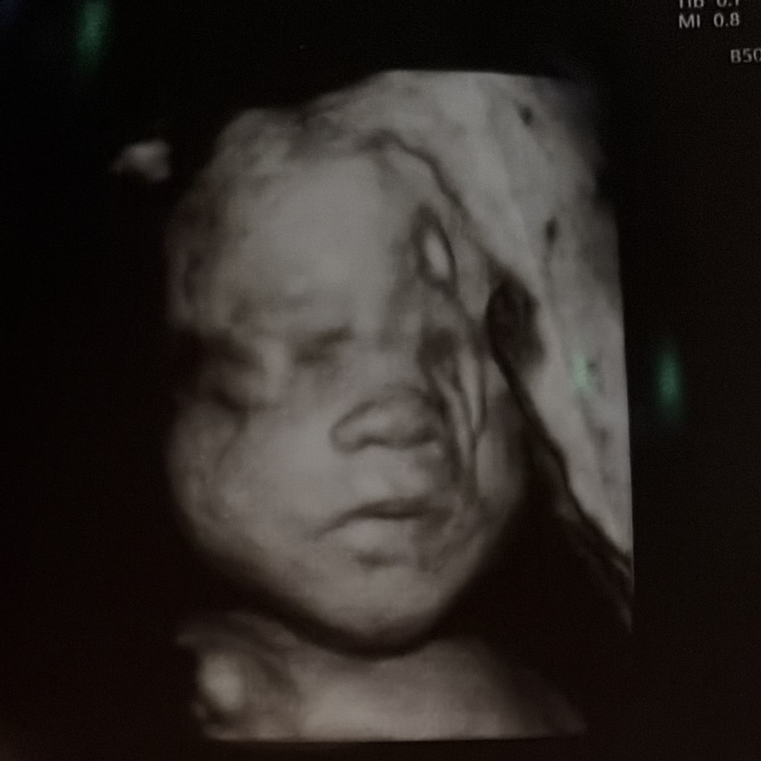 Photo shared by Claire for their Babylist baby registry.