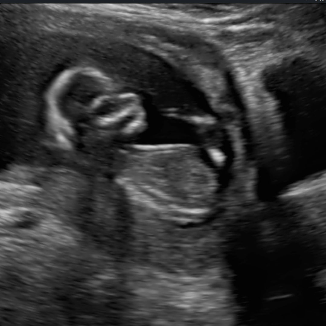 Photo shared by Allison for their Babylist baby registry.