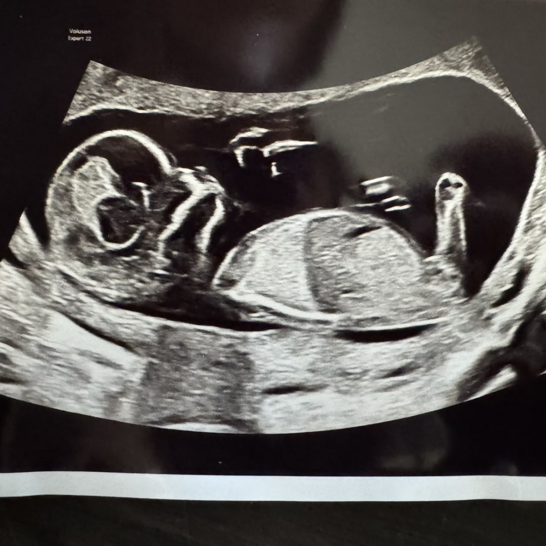 Photo shared by Bianca for their Babylist baby registry.