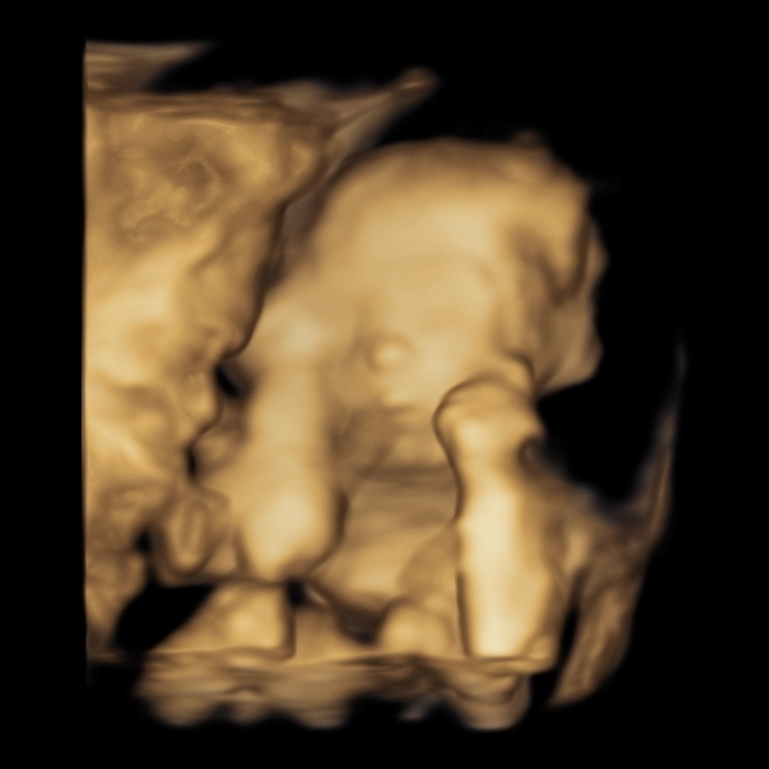 Photo shared by Cari for their Babylist baby registry.