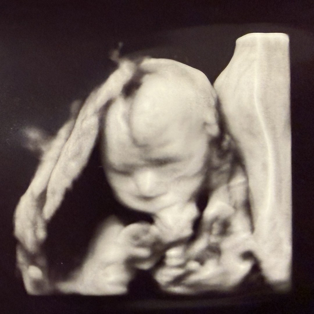 Photo shared by Anna for their Babylist baby registry.