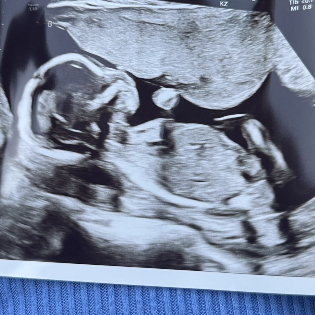 Photo shared by Dominique for their Babylist baby registry.