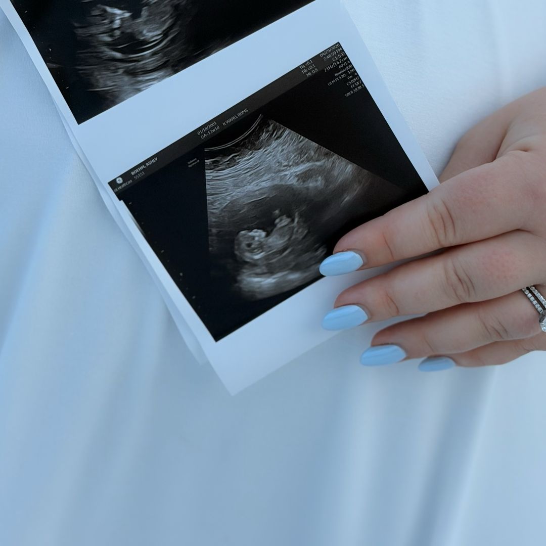Photo shared by Ashly for their Babylist baby registry.